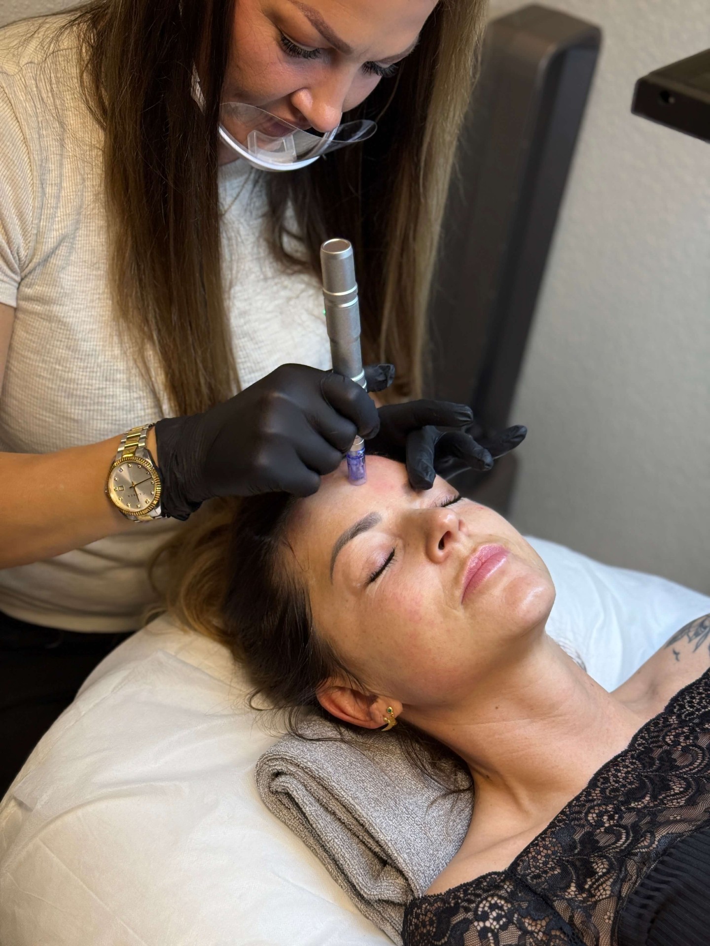 PDRN + Microneedling – Intensiv Hudreparation