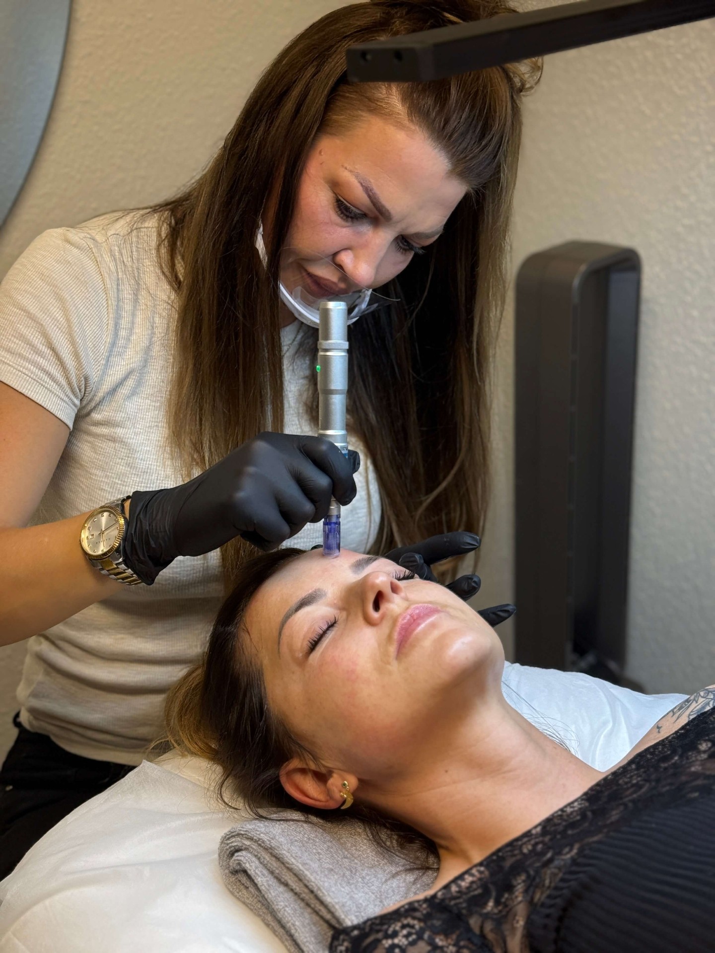 Exosomer + Microneedling mod hårtab